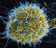 Ebola Patient in Nigeria Identified as Wife of Swiss Diplomat – THISDAYLIVE