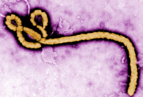 Uganda says no active Ebola cases after Nigeria confirms infection