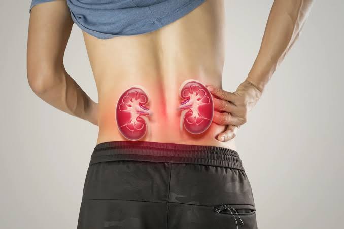 Over 9,000 Nigerians Diagnosed with Kidney Disease Monthly, Says Surgeon – THISDAYLIVE