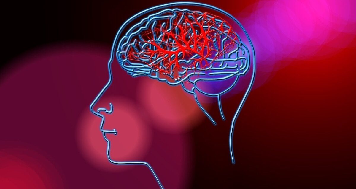 Stroke treatment costs exceed monthly earnings in Africa – Study