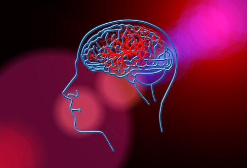 Stroke treatment costs exceed monthly earnings in Africa – Study